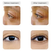 NEW リバイタラッシュ アドヴァンス 3.5ml【最強のまつげ美容液】送料無料