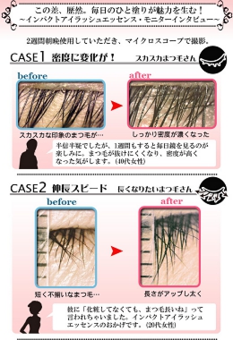 魅惑の女優まつ毛へ！マシュマロコスメ インパクトアイラッシュエッセンス【まつげ美容液】