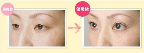 塗るだけ、簡単3ステップで憧れのぱっちり二重にローヤルアイムエクストラ