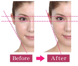 小顔フェイシャル cassage カッサージプレートステンレス