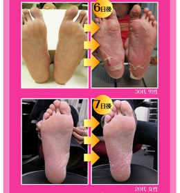 人気角質ケア商品　フットピーリングパック　ペロリン