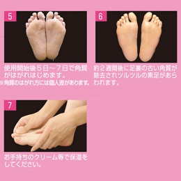人気角質ケア商品　フットピーリングパック　ペロリン